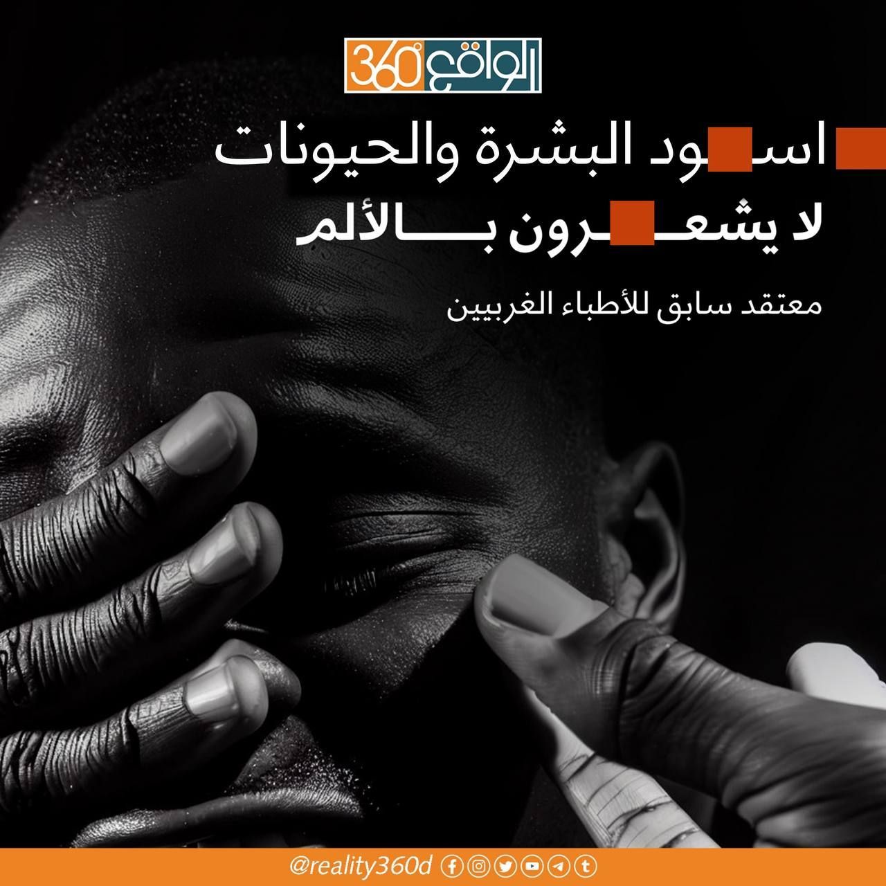 لفترة طويلة، كان يعتقد العديد من الأطباء الغربيين بأن السود لا يشعرون بالألم كالحيوانات.