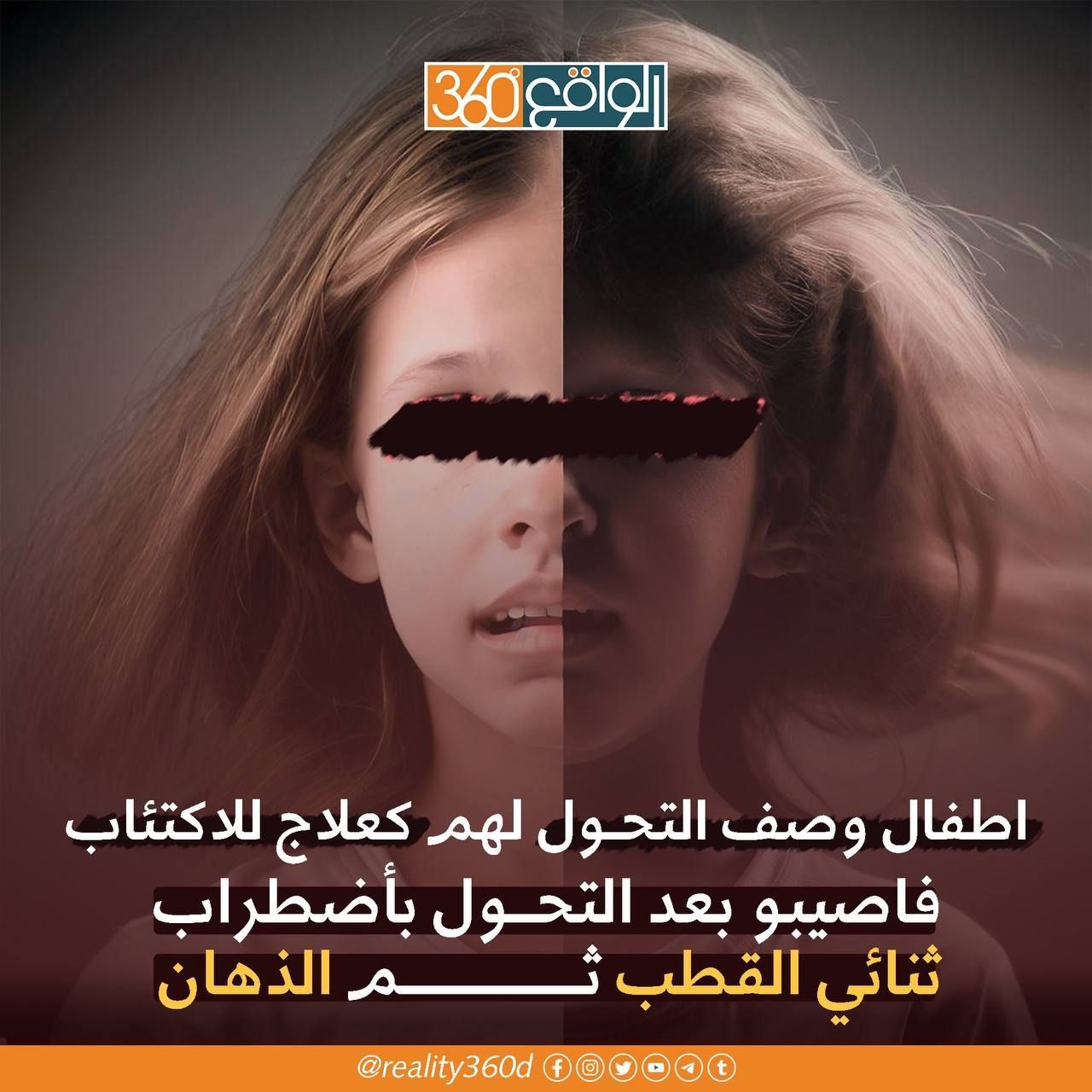 اطفال وصف التحول لهم كعلاج للاكتئاب فاصيبو بعد التحول باضطراب ثنائي القطب ثم الذهان