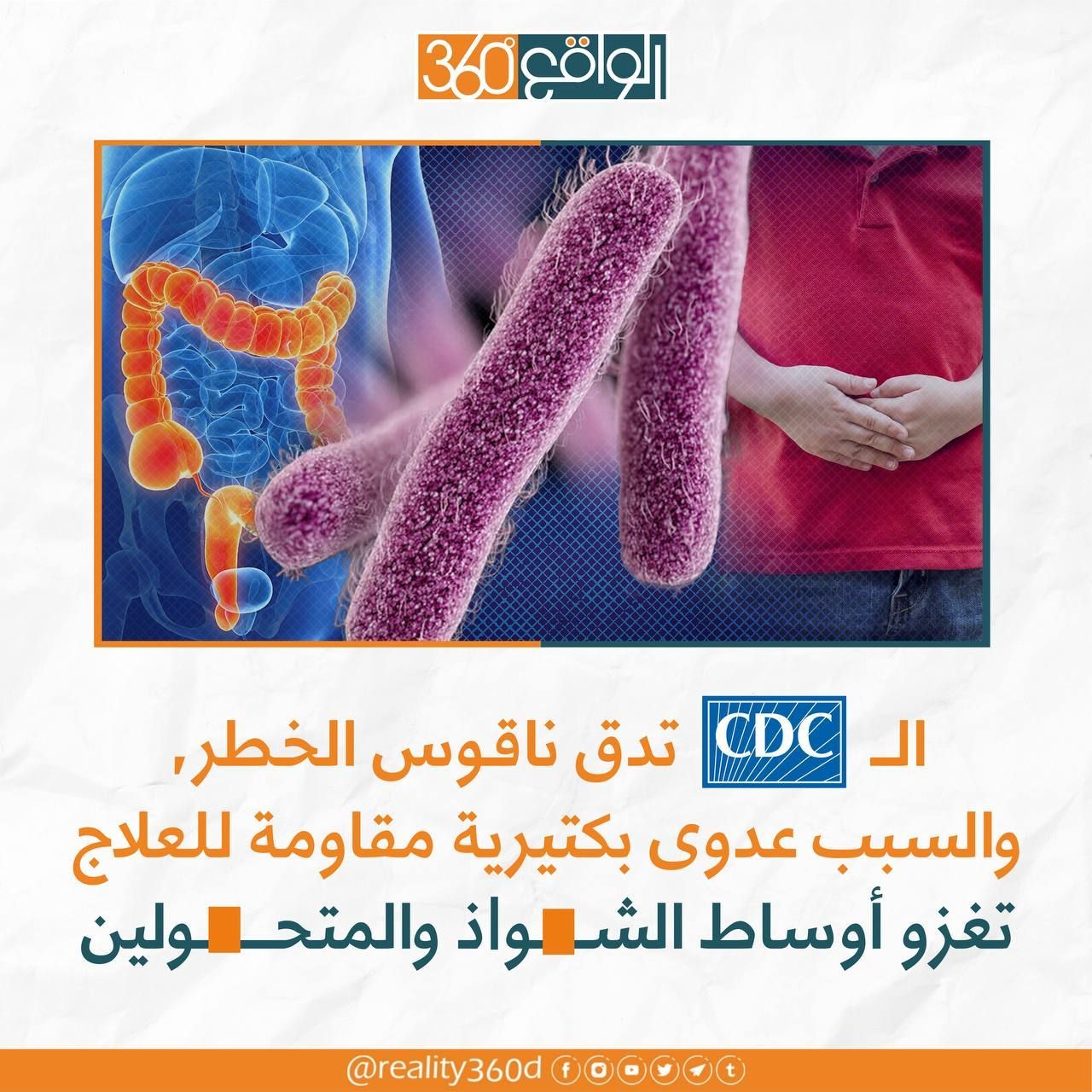 الcdc تدق ناقوس الخطر والسبب عدوى بكتيرية مقاومة للعلاج تغزو اوساط الشواذ والمتحولين