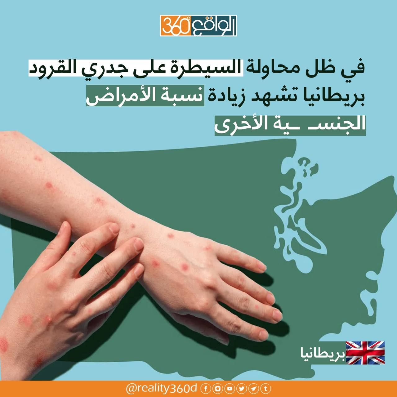 في ظل محاولة السيطرة على جدري القرود بريطانيا تشهد زيادة نسبة الأمراض الجنسية الأخرى